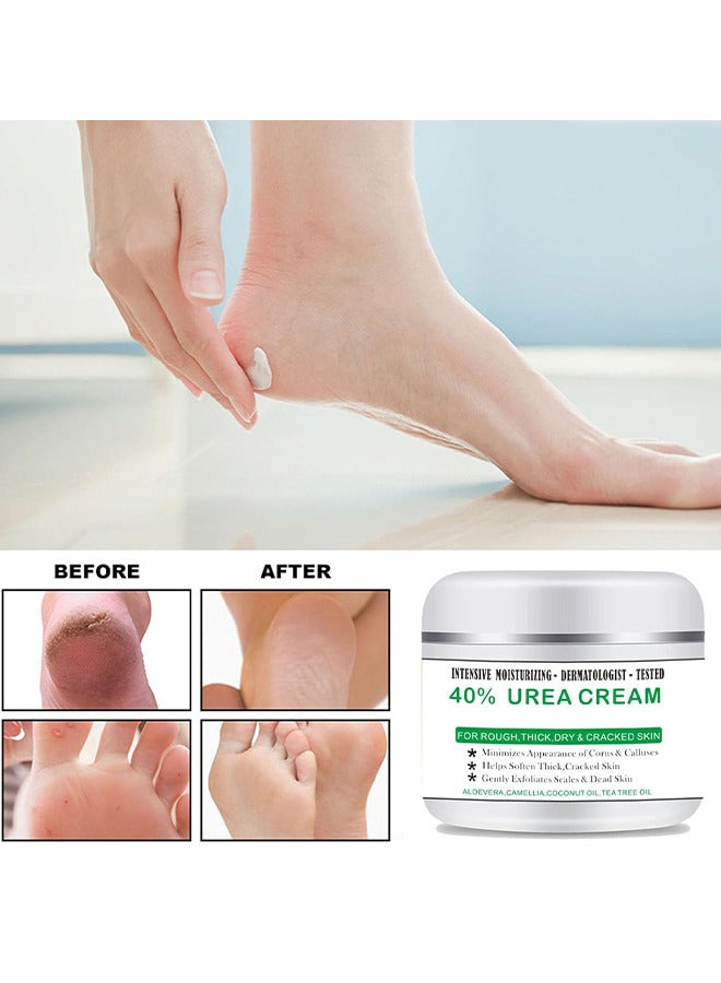 40% Urea Cream And 2% Salicylic Acid, Percent For Feet Maximum Strength, Callus Remover, Dead Skin Exfoliation, Hand And Foot Cream For Dry Cracked Hands, Elbows, Feet, Heels, Knees 100G