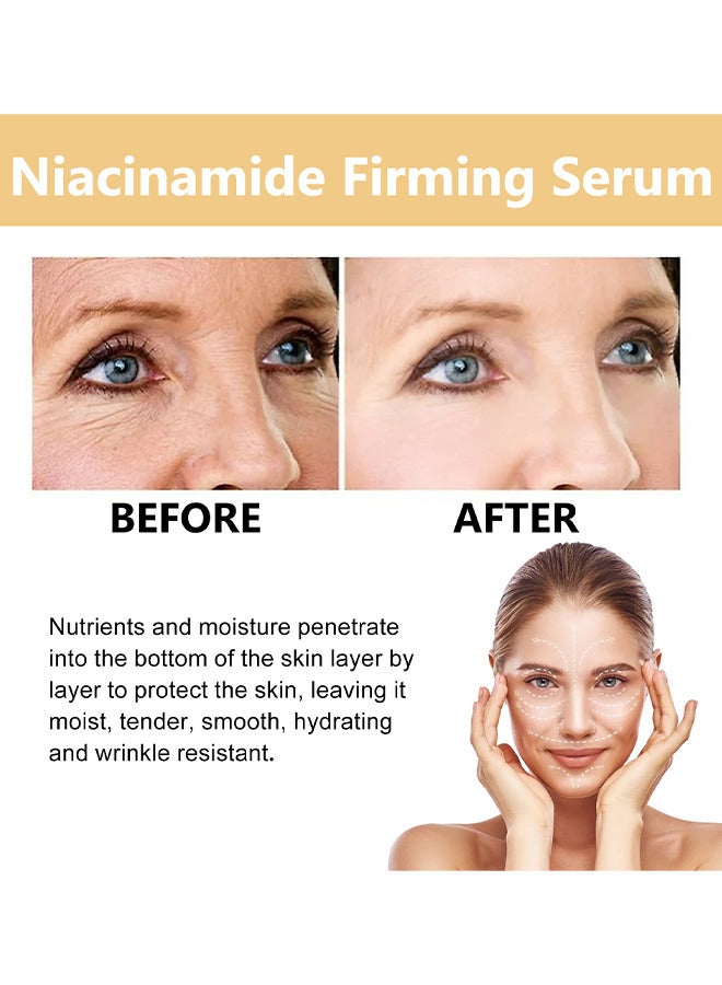 Niacinamide Serum, Effectively Reduce Fine Lines And Wrinkles, Slow Down Signs Of Aging, Brighten Skin Tone, And Improve Dull Skin Tone, Suitable For All Skin Types, 40ML