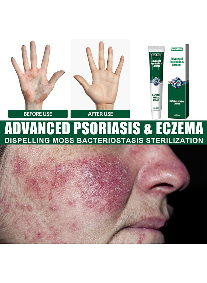 Organic Psoriasis And Eczema Herbal Healing Cream, Chinese Herbal Eczema, Natural Herbal Cream, Psoriasis Ointment Cream, Moisturising Cream, Itch And Rash Ointment, Itch Relief Cream 20G