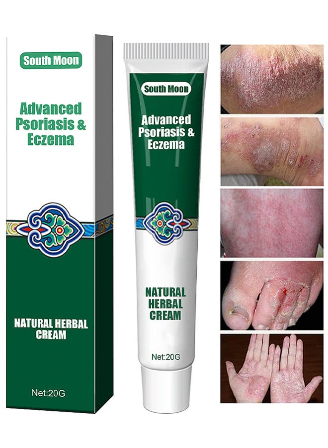 Organic Psoriasis And Eczema Herbal Healing Cream, Chinese Herbal Eczema, Natural Herbal Cream, Psoriasis Ointment Cream, Moisturising Cream, Itch And Rash Ointment, Itch Relief Cream 20G