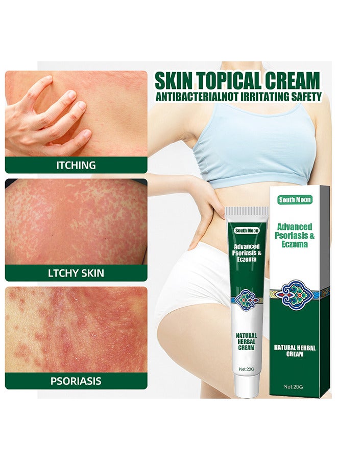 Organic Psoriasis And Eczema Herbal Healing Cream, Chinese Herbal Eczema, Natural Herbal Cream, Psoriasis Ointment Cream, Moisturising Cream, Itch And Rash Ointment, Itch Relief Cream 20G