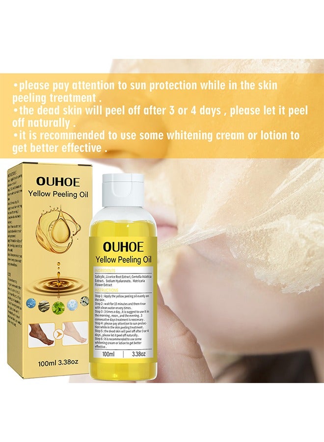 Yellow Peeling Oil Super Strength Exfoliating Dark Skin for Body, Cleansing and Moisturizing100ml