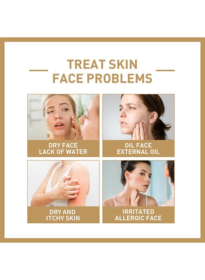 Rice Toner, 77.78% Rice Extract, Effectively Replenish Nutrients Improve Dryness Soften Cuticles Minimize Poreslighten Acne Scars Soothe And Repair Skin 150ml