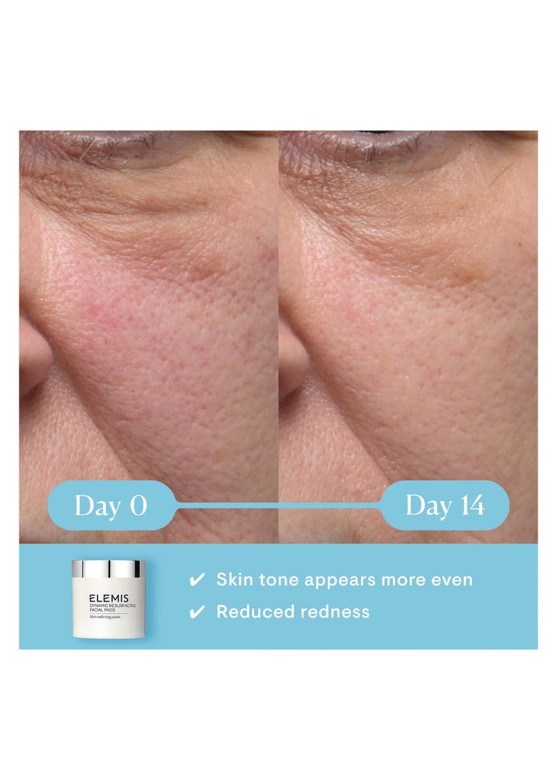 ELEMIS Dynamic Resurfacing Facial Pads | Gentle Dual-Action Textured Treatment Pads Conveniently Smooth, Resurface, and Exfoliate Skin