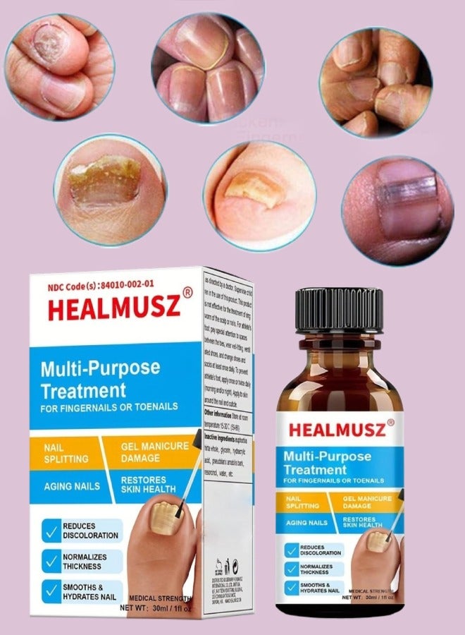 Multi Purpose Nail fungus treatment Fingernails and Toenails Extra Strength Fungus Treatment Toenail Fungus Nail Repair Treatment Solution Restoring Healthy Nails Renewal Foot Gel 30 ml