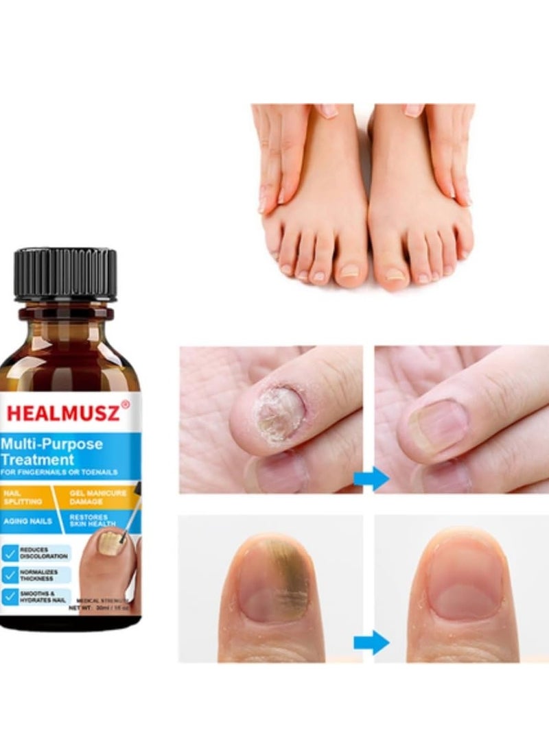 Multi Purpose Nail fungus treatment Fingernails and Toenails Extra Strength Fungus Treatment Toenail Fungus Nail Repair Treatment Solution Restoring Healthy Nails Renewal Foot Gel 30 ml