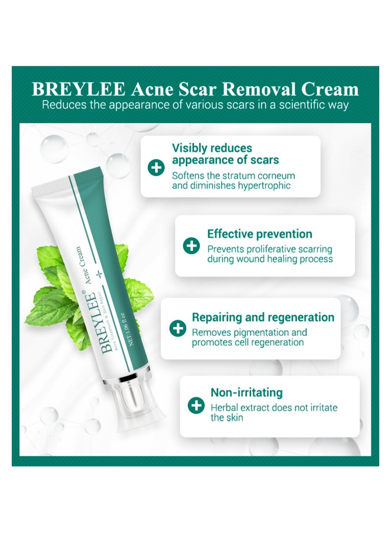 Acne Scar Cream Skin Repair Skin Care Scar Acne Treatment Whitening Cream
