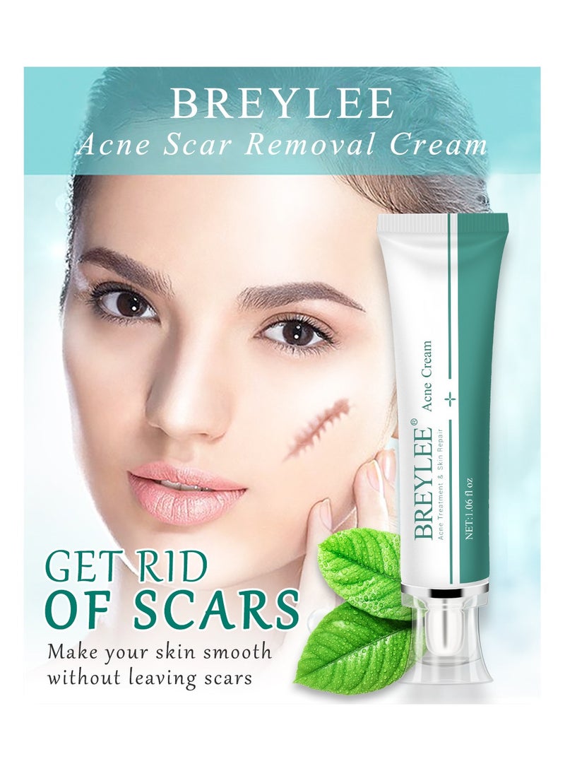 Acne Scar Cream Skin Repair Skin Care Scar Acne Treatment Whitening Cream