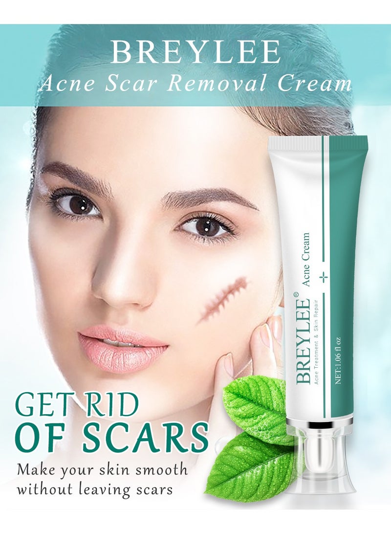 Acne Scar Cream Skin Repair Skin Care Scar Acne Treatment Whitening Cream