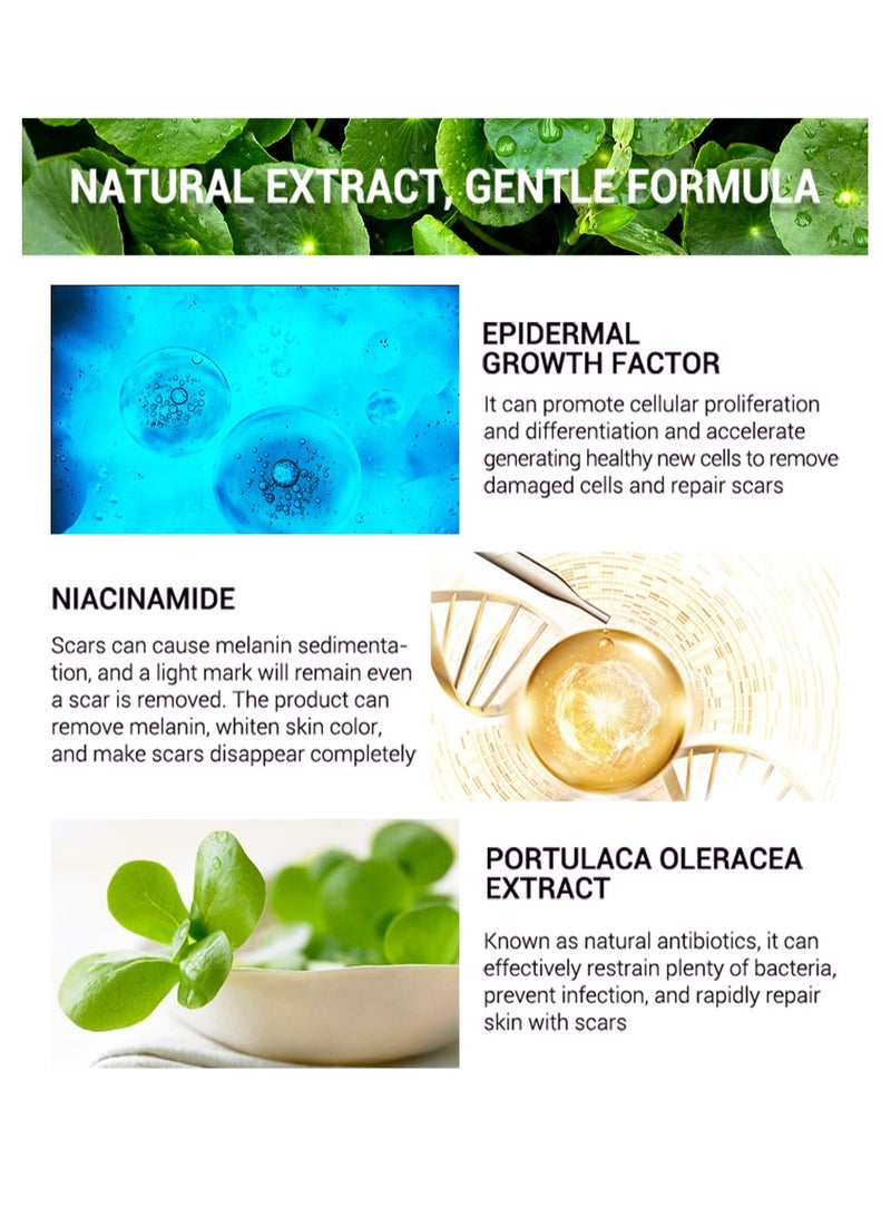 Acne Scar Cream Skin Repair Skin Care Scar Acne Treatment Whitening Cream