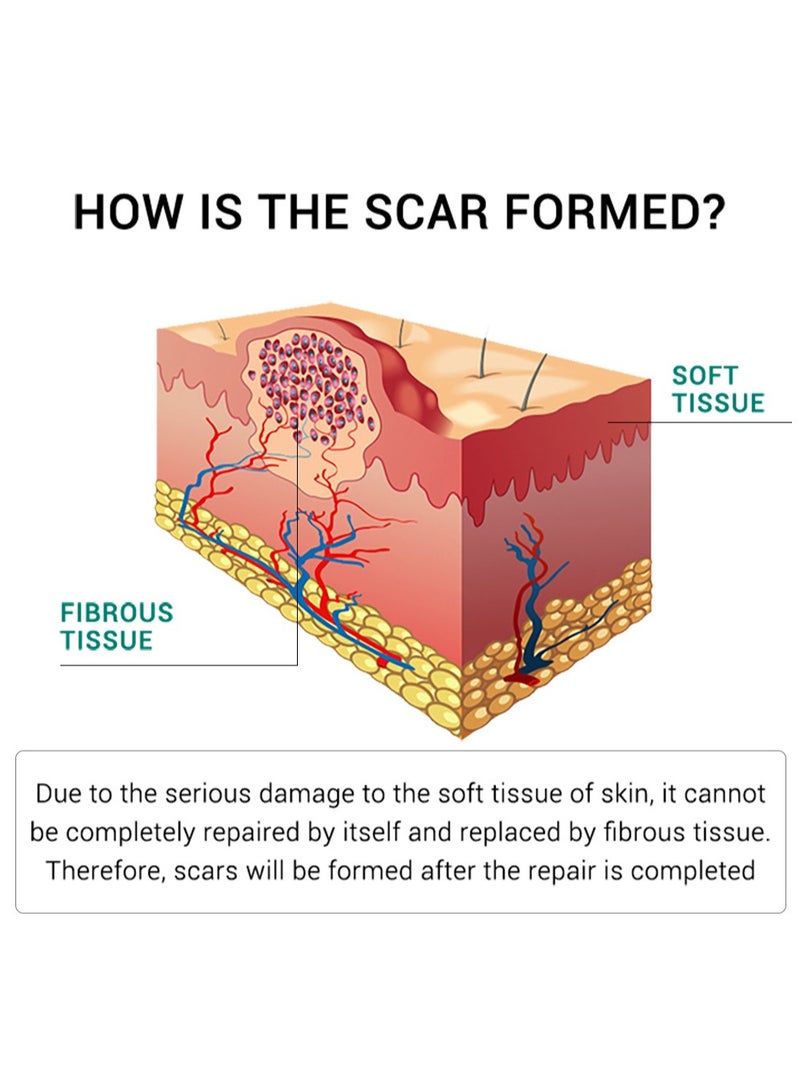 Acne Scar Cream Skin Repair Skin Care Scar Acne Treatment Whitening Cream