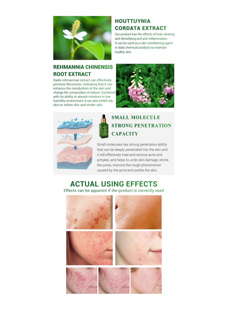 Pore Minimizer Serum (Step 2) Green Tea 17ml