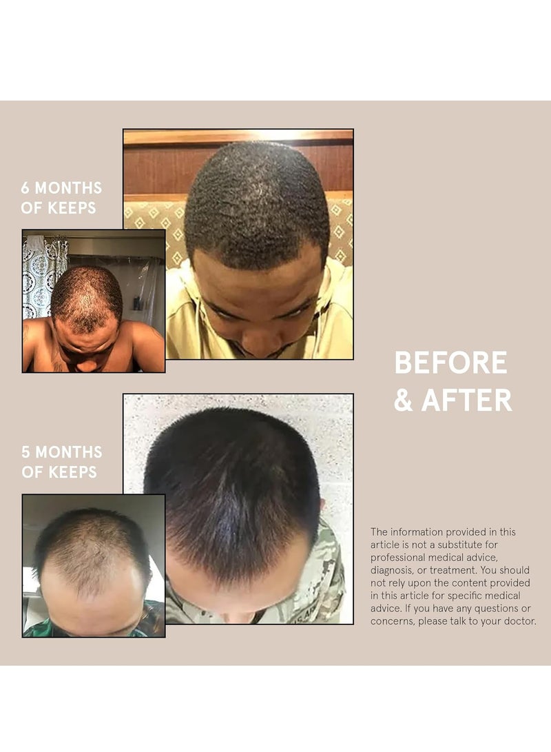 Keeps Extra Strength Minoxidil for Men Topical Aerosol Foam 5%, Hair Growth Treatment - 3 Month Supply (3 x 2.11oz Bottles) - Thicker, Longer Hair - Slows Hair Loss & Promotes Hair Regrowth