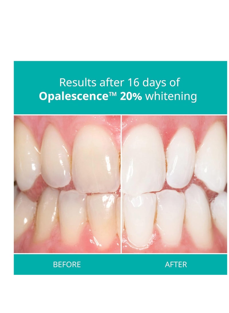 Opalescence 20% Teeth Whitening Refill Kit (2 Packs / 4 Syringes) Carbamide Peroxide. Made by Ultradent, in Mint Flavor. Tooth Whitening Refill Syringes - B-5196-4