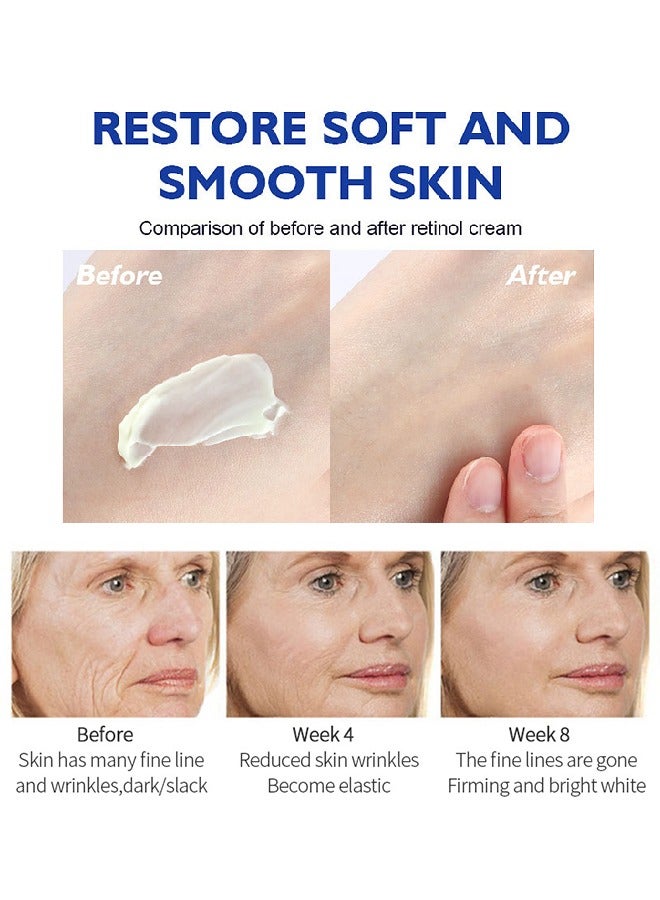 Retinol Face Cream- Anti-Wrinkle Anti Aging, Hyaluronic Acid Active Retinol Cream 50g