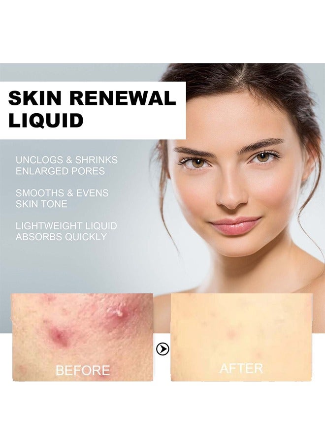 Skin Renewal liquid- pore clear 2% BHA Salicylic Acid Exfoliant Gentle Exfoliator for Blackheads Large Pores Wrinkles and Fine Lines Shrinks Enlarged Pores Smooths and Evens Skin Tone Face Exfoliator