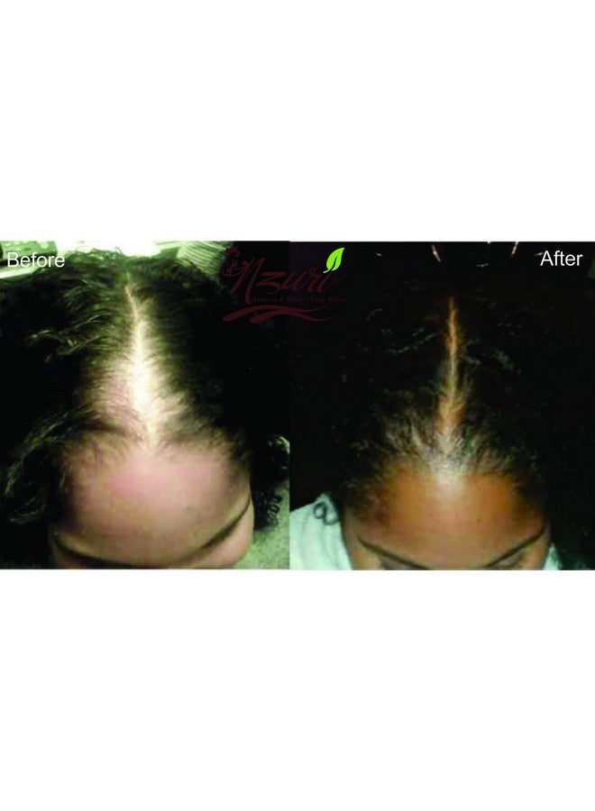 Nzuri Elixir Hair Skin And Nail With Vitamin D 32 Oz + Nzuri Hair Follicle Food 61 Ancient Miracle Hair Growth Oil 4Oz Vitamins To Make Hair Grow Long Intense Grow Long Hair Supplements Combo Pack