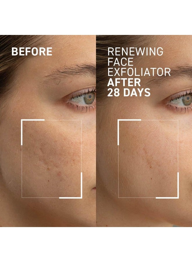 Dr. Brandt Microdermabrasion Renewing Face Exfoliator Reduces Dull Skin Uneven Texture Fine Lines Acne Scars And Wrinkles 2 Oz 60 G