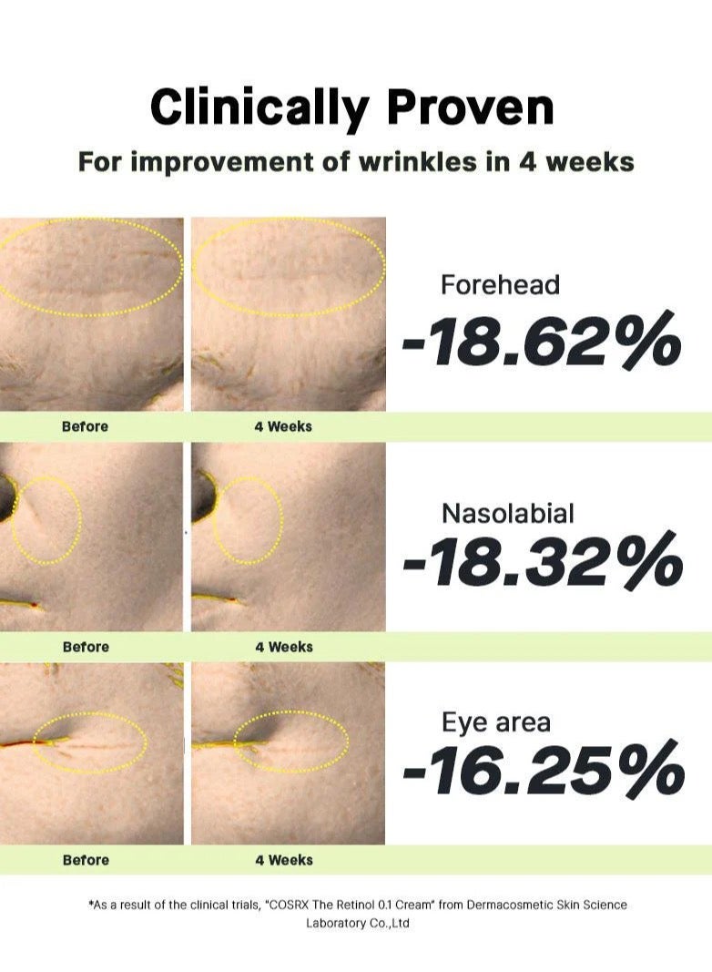 Retinol 0.1 Cream - Low Irritation Formula with 0.1% Pure Retinol 20ml