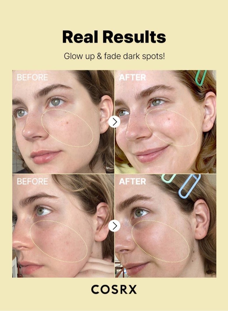Synergy Duo Blemish & Brightening Booster - The 6 Peptide Skin Booster Serum - Vitamin C 23 Serum -  Certified Original Anti-Aging Solutions for Skin Rejuvenation 170ml