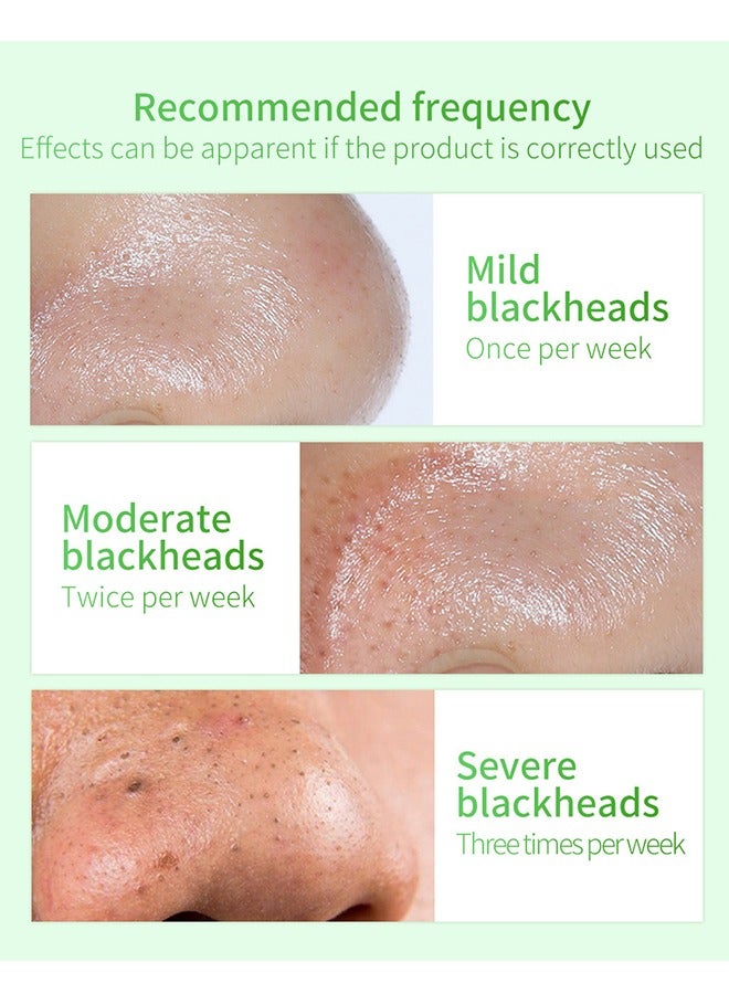 Blackhead Remover Mask - Blackhead Remover Mask Peel Off Blackhead Mask 2 In 1 Green Tea Oil Blackhead Removal 100 Pcs Blackhead Remover Mask For Pores, Nose, Chins And Face