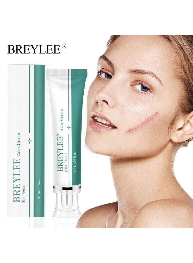 Skin Repair Acne Cream,-promote the regeneration of collagen, fade scars, improve scar skin, deep moisturizing skin