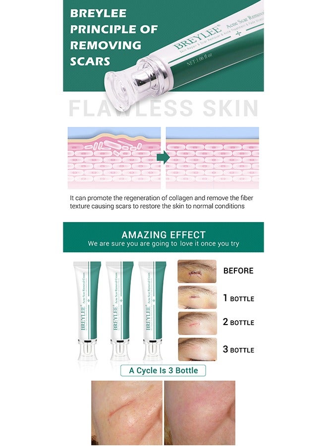Skin Repair Acne Cream,-promote the regeneration of collagen, fade scars, improve scar skin, deep moisturizing skin