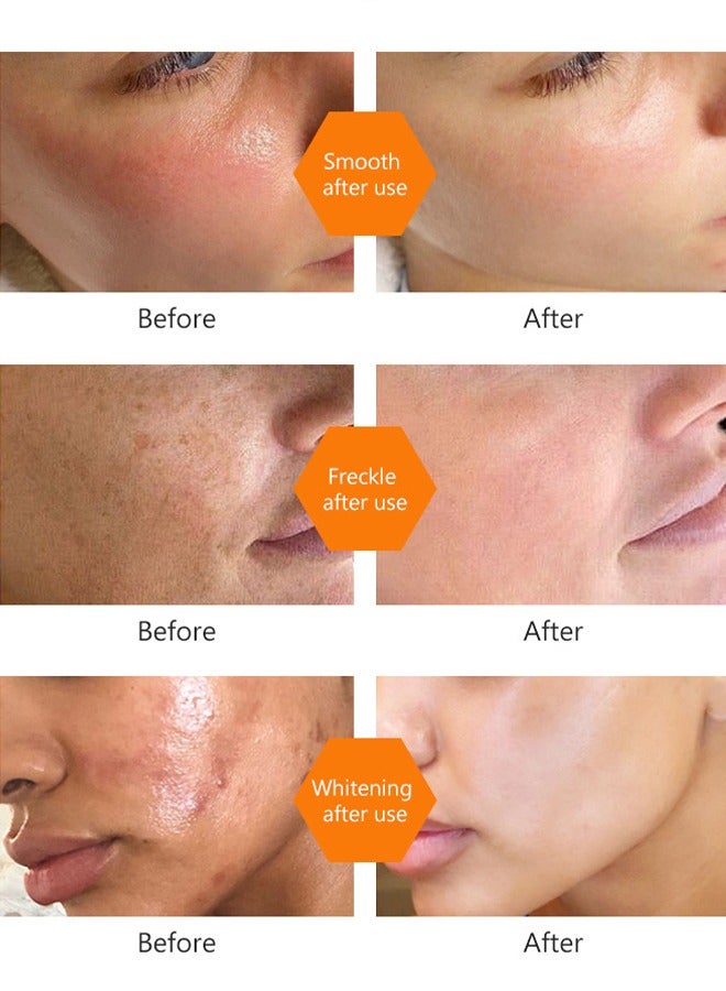 Turmeric Toner Dark Spots Eraser-Corrector Toner 100ML Facial Toner For Acne Prone Skin Dark Spot Remover For Face Hydrating Face Toner For Women Treatment