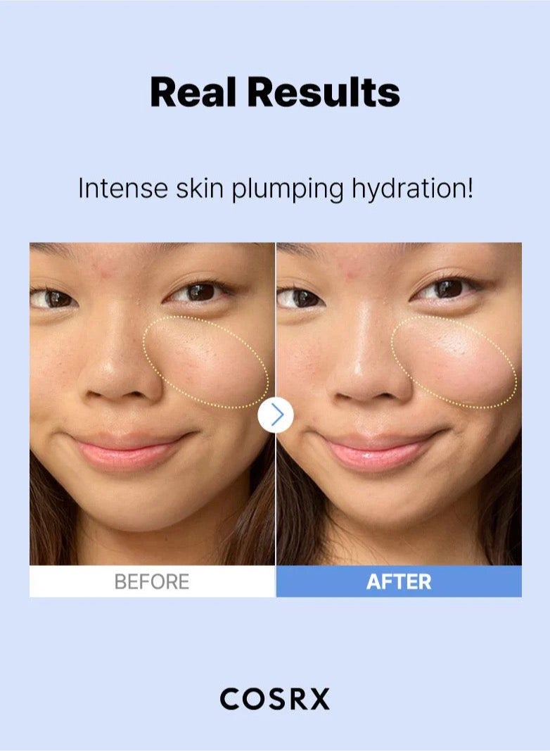 Hyaluronic Acid 3 Serum - Advanced Hydration Booster for Dewy, Radiant Skin - High Potency Formula Infused with 3% Hyaluronic Acid 20ml