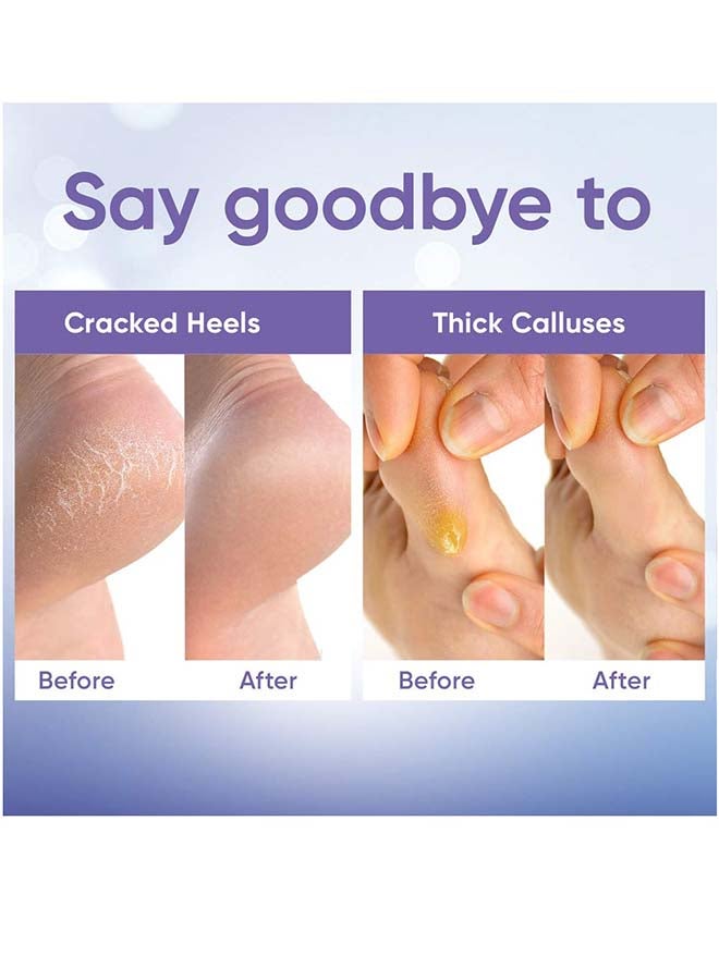 Foot Peeling Mask | Skin Care Pedicure Foot spa - Foot Mask & Foot Callus Remover with Aloe Vera Extract for Baby Soft Skin | Woman & Man | Remove Dead Skin, Cracked Feet & Callus | Lavender (2 Pairs)