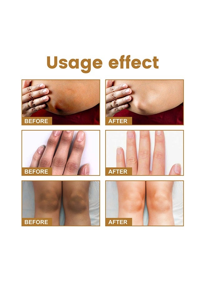قطرات العلاج مصل تفتيح مفصل اليد المبيض ، واستعادة علاج اليدين ، والترطيب ، والتقشير وتقليل التصبغ غير المتوازن ، لإزالة مرفق المفصل الداكن ، بشرة أكثر إشراقا وثباتا