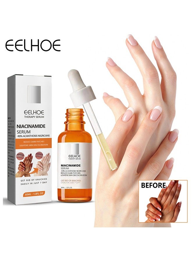 Niacinamide Serum- Reduce Dark Patches Restoring Hand Treatment, Moisturizing, Exfoliates and Reduces Unbalanced Pigmentation, for Removing Dark Elbow and Knee , Brighter Firmer Skin