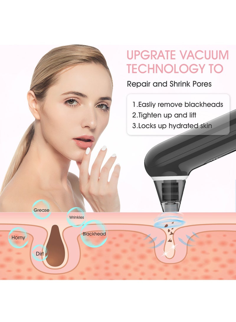 Head Remover Tools Blackhead Pore Vacuum: Electric Facial Pore Cleaner 3 Suction Levels, Rechargeable Acne Pimple Comedone Extractor Skin Care for Face Nose (Black)