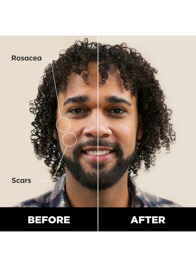 Concealer Stick Tool For Men Dark Eclipse Natural Pigments Hides Imperfections Acne Razor Burns Scars & Rosacea Highly Adaptable Shades For Easy Undetectable Coverage All Skin Tones