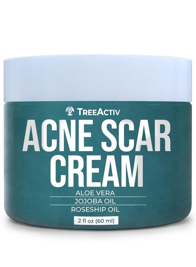 Acne Scar Treatment 2 Fl Oz Acne Scar Cream For Face Gentle Acne Scars And Dark Spot Remover Scar Lotion For Stretch Marks And Body Scars Acne Scar Removal For All Skin Types 500+ Uses