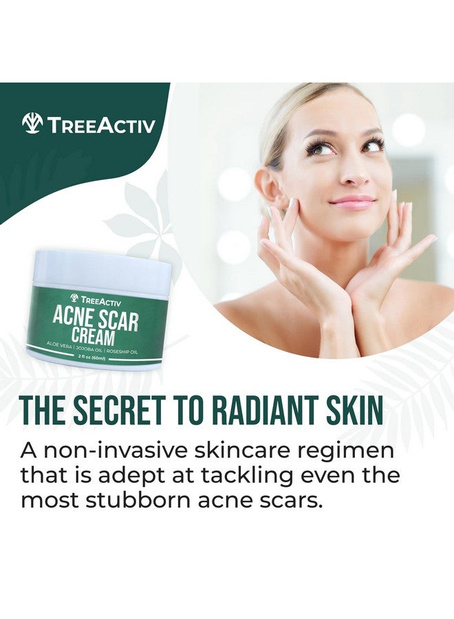Acne Scar Treatment 2 Fl Oz Acne Scar Cream For Face Gentle Acne Scars And Dark Spot Remover Scar Lotion For Stretch Marks And Body Scars Acne Scar Removal For All Skin Types 500+ Uses
