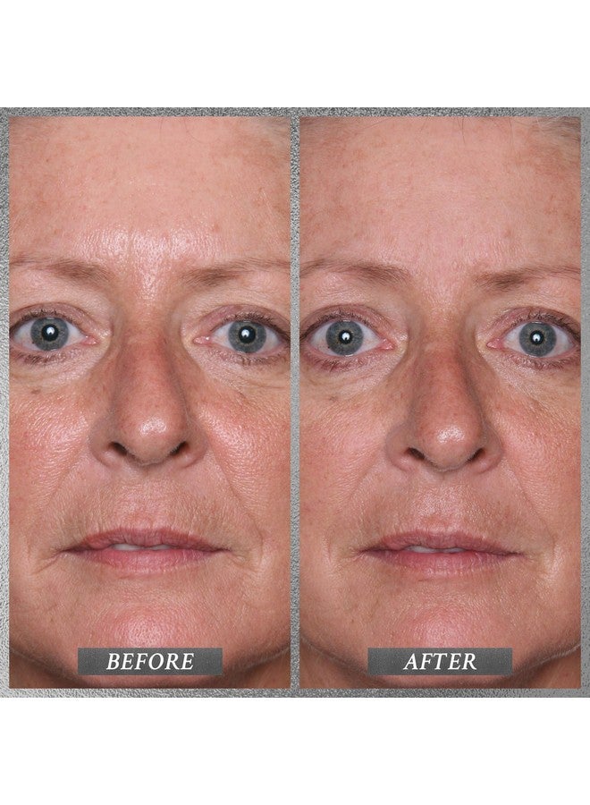 Beauty Platinum Firm And Lift Creme Firming And Hydrating Face Moisturizer For Dry Skin And All Skin Types Face Moisturizer For Skin Firming And Lifting 1.7 Oz