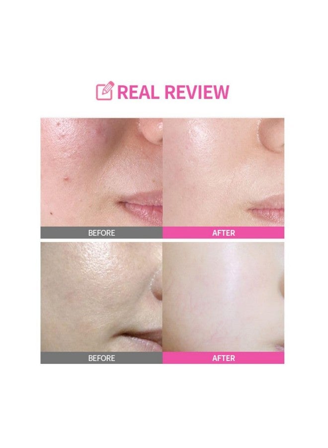 Apple Peel Vita Moisture Cream Facial Moisturizing Cream Hydrating Dry & Oily Skin Soothe & Moisturize Rough Skin Korean Skincare