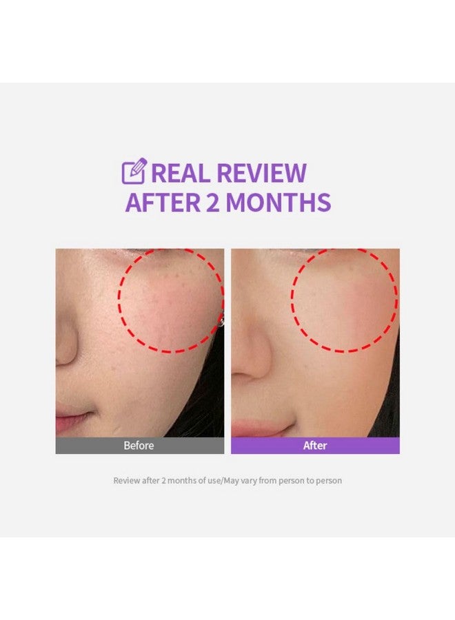 Meoru Podo Vita C Dark Spot Cream Facial Moisturizer For Brightening Dark Spots Correcting Blemishes Soothing Vitamin C Niacinamide Hyaluronic Acid Cica Korean Skincare