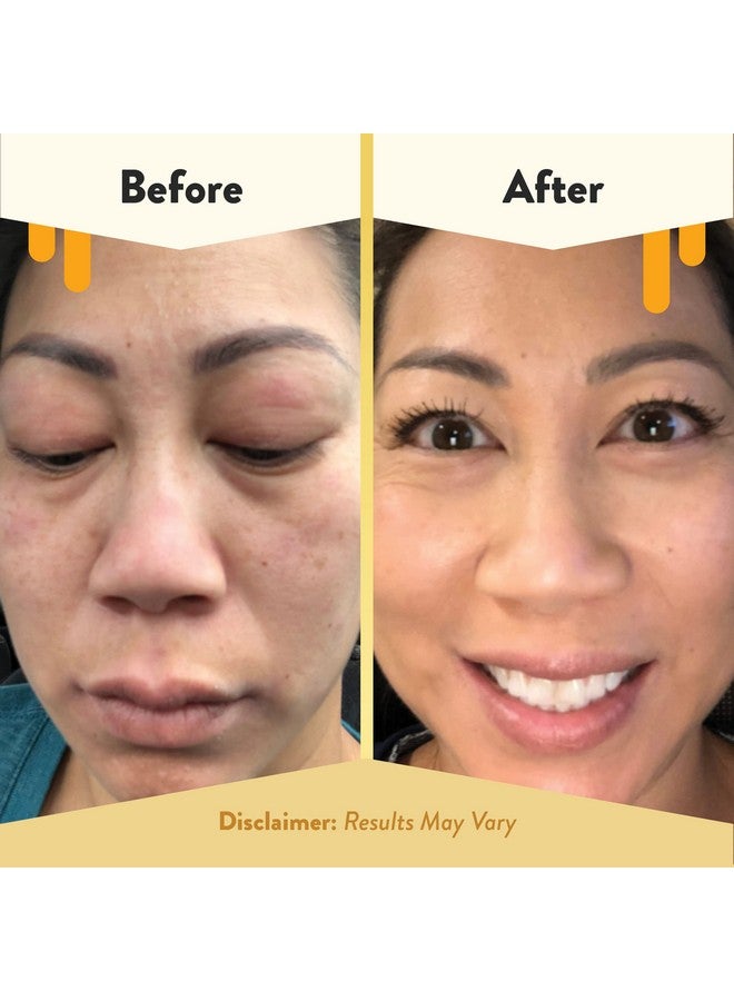 Soothing Facial Cream Eczema Lotion For Face Eyelids Lips And More Natural Dry Skin Repair (2 Oz)