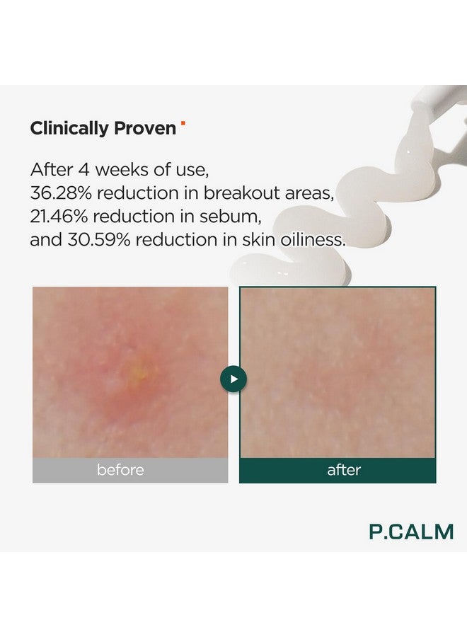 Centella Trouble Spot 0.5 Fl.Oz Vegan Breakout Relief Cream For Sensitive Skin Korean Skin Care
