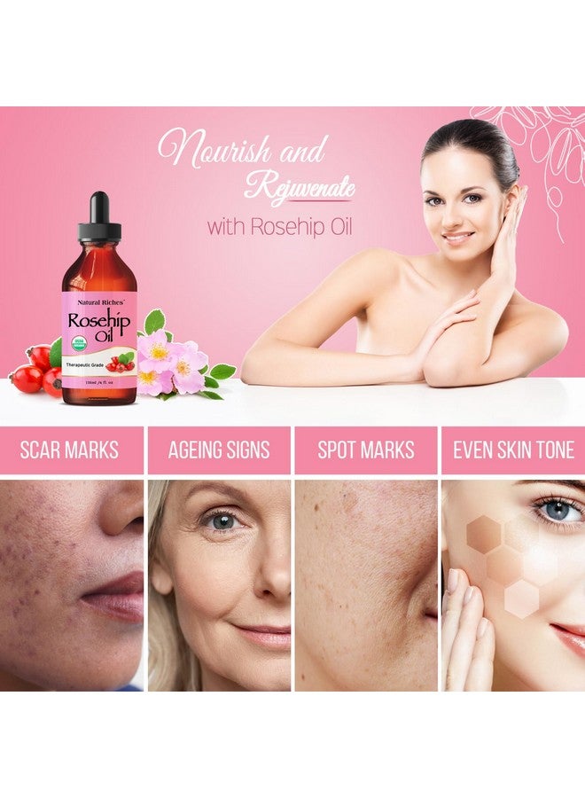 Organic Rosehip Seed Oil For Face 100% Pure Natural Cold Pressed Unrefined Nongmo Carrier Oil For Skin Hair & Nails. 4 Fl Oz.