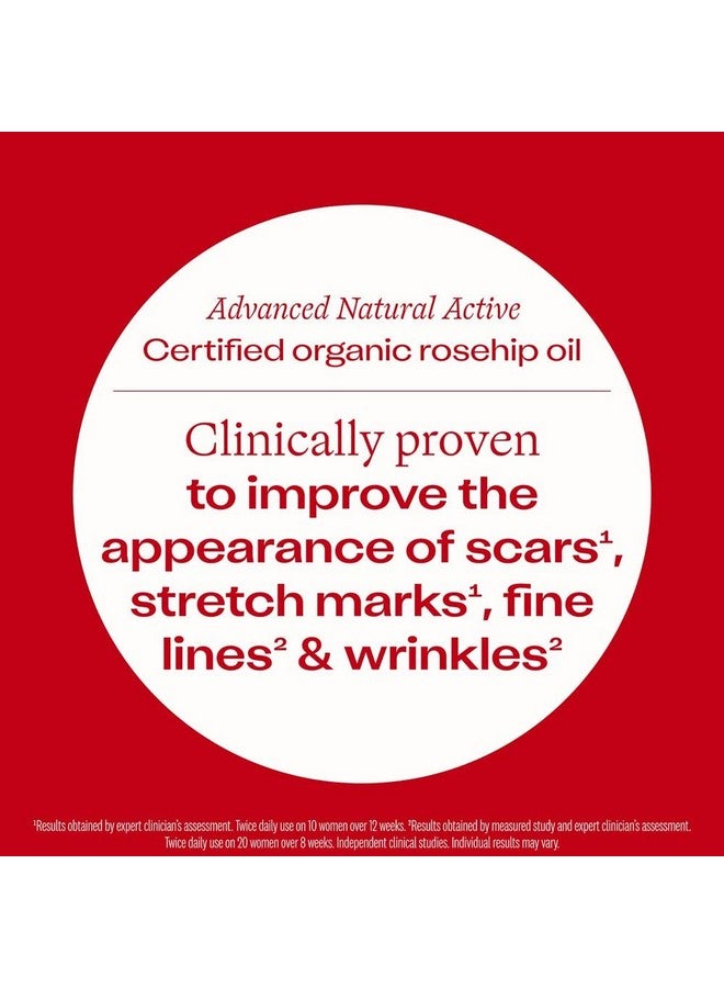 Aromatic Certified Organic Rosehip Oil For Face 1.5 Fl Oz Hydrate & Repair Skin To Reduce Stretch Marks Scars Fine Lines & Wrinkles