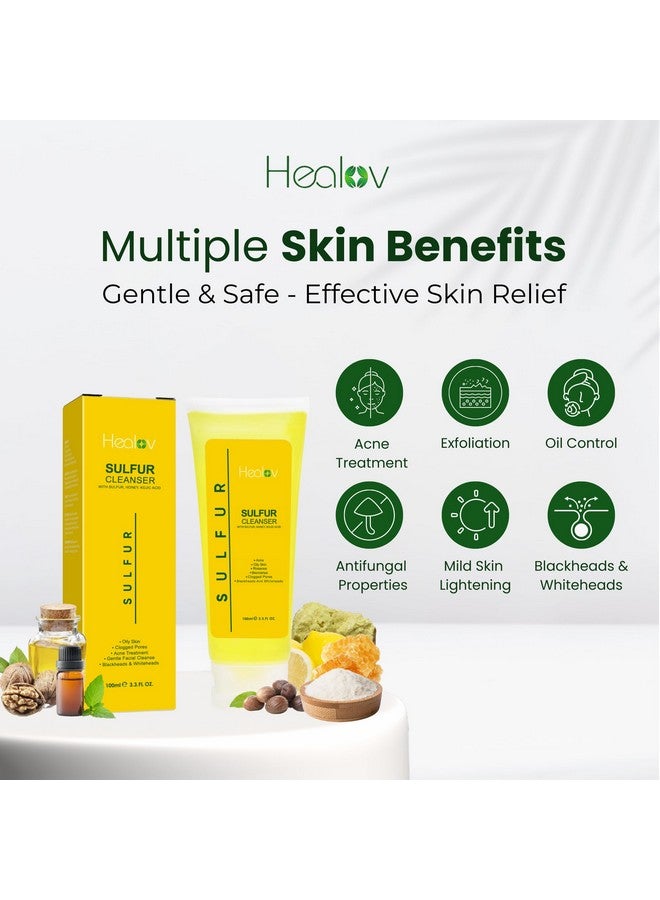 Sulfur Soap Sulfur Face & Body Wash For Acne Sulphur Exfoliating Facial Cleanser Absorbs Excess Oil Reduces Breakouts & Cleanses Skin Natural Cystic Acne Rosacea Skin Care Treatment