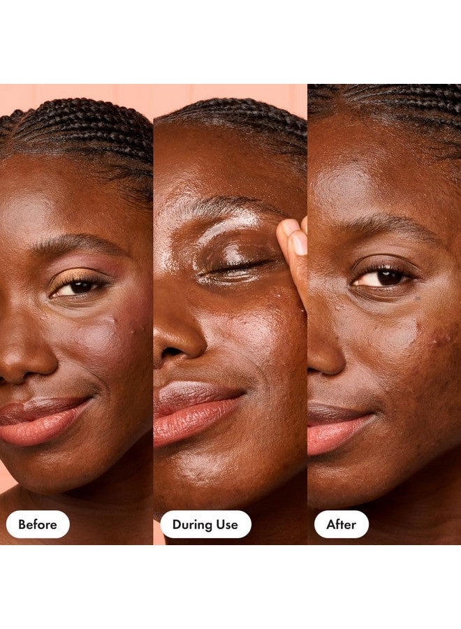 Dissolve Away Daily Cleansing Balm Helps Remove Makeup And Grime Won’T Clog Pores Suitable For Sensitive And Acneprone Skin (2.2 Fl Oz)