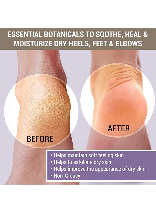 Cracked & Crusty™ Healthy Foot Cream Moisturizes Softens And Heals Dry Feet Cracked Heels And Dry Elbows With Salicylic Acid Urea Shea Butter Ap4 Aloe And Vitamins 4.2 Ounces