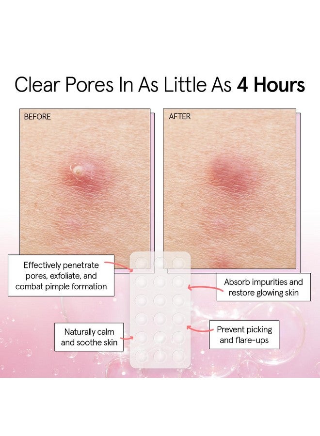 Pimple Patches For Face (Round 36 Count) Hydrocolloid Acne Patches For Face Vegan Crueltyfree Zit Patches For Face Blemish Patches Pimple Stickers Zit Stickers…