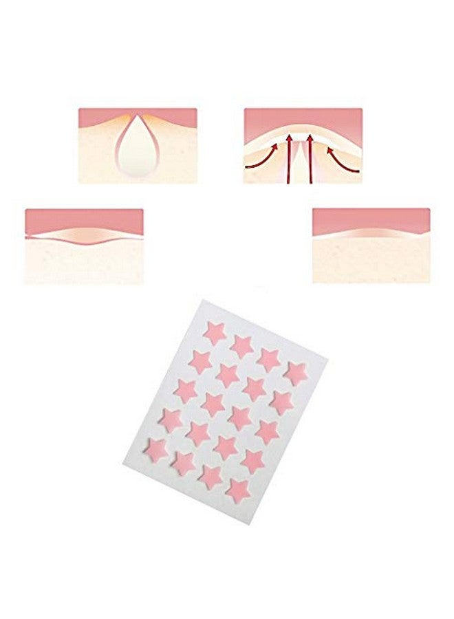 Acne Pimple Patch Hydrocolloid Absorbing Patch Clear Acne Stickers (2 Sheets/40Patchs)