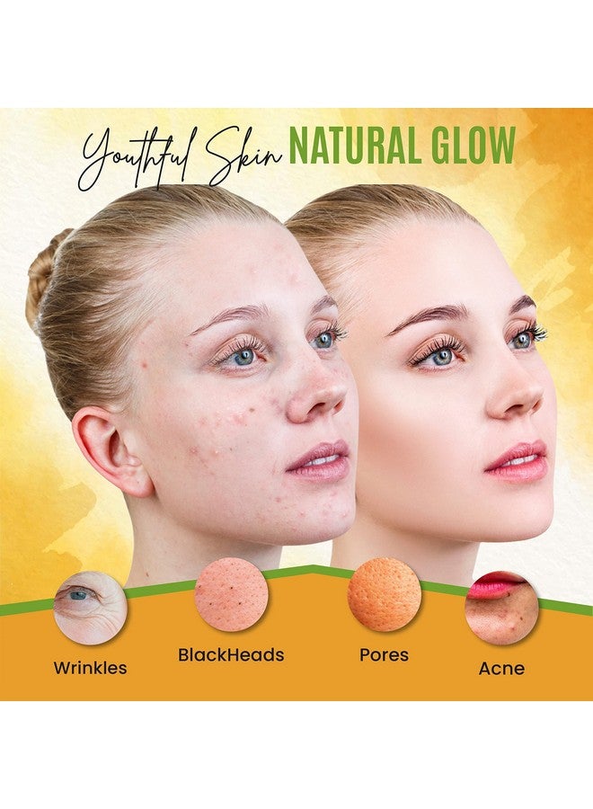 Organic Turmeric Face Mask Detox Clay For Clear Radiant Skin Acne & Scars Reduction Healing Clay Pore Cleansing Facial Mask Improve Skin Tone And Texture Allnatural 5.29Fl Oz