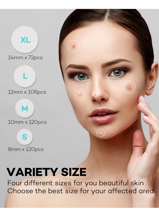 Acne Patch Pimple Patch 4 Sizes 420 Patches Acne Absorbing Cover Patch Hydrocolloid Invisible Acne Patches For Face Zit Patch Acne Dots Tea Tree Calendula Oil 3 Pack